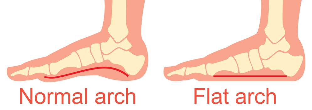 Arches toes heels soles aggressive rough footjob large