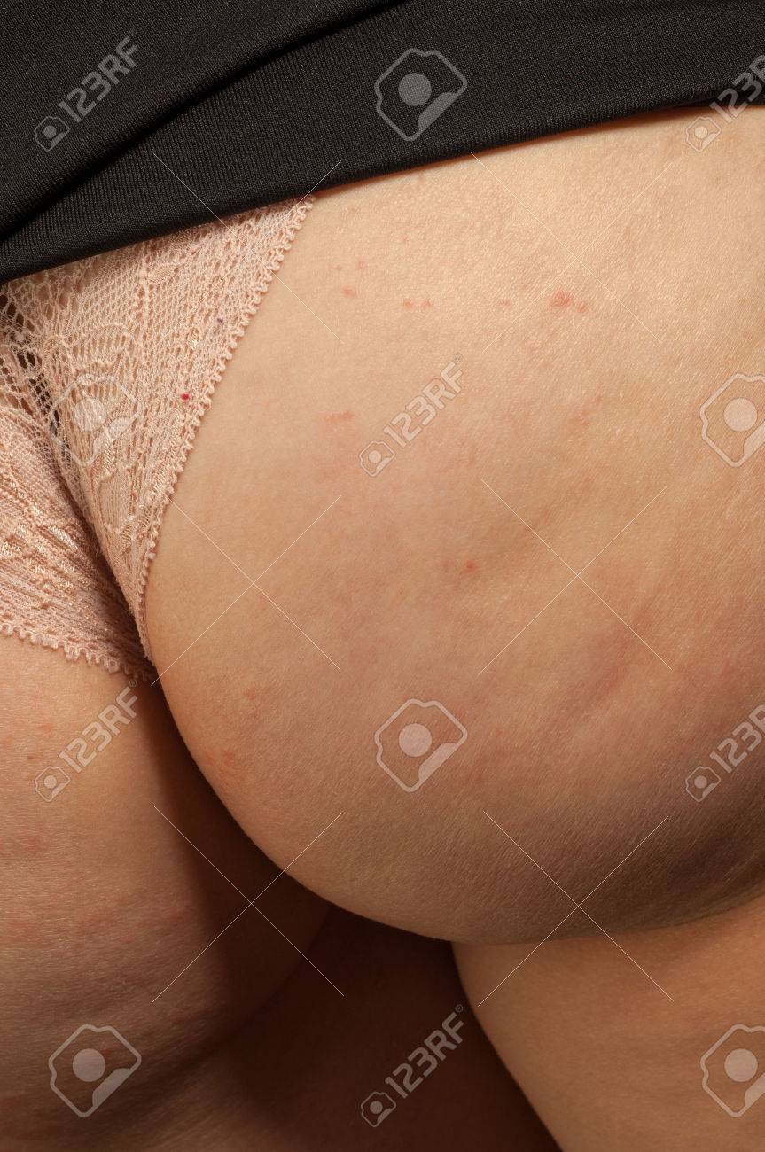 Ass fat women pic